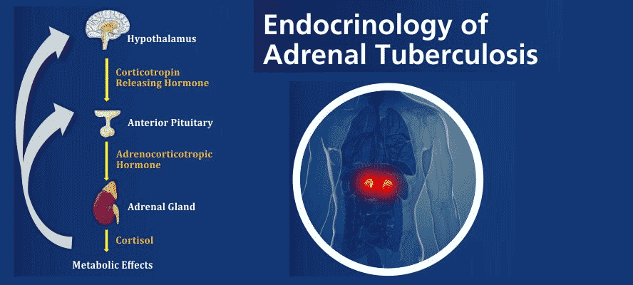 Tuberculosis And Adrenal Glands