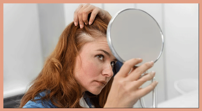 Female Pattern Baldness: Tackling Hair Loss in Women