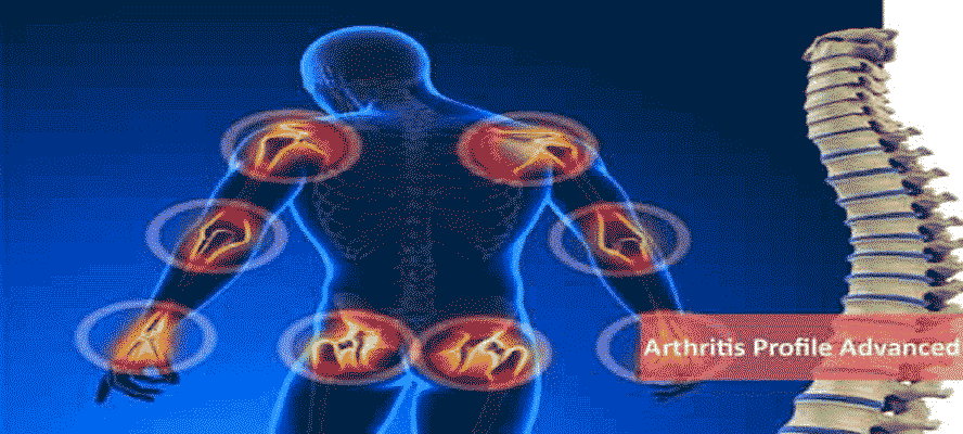 Arthritis Types Conditions Managing Diagnosis Myths And Facts