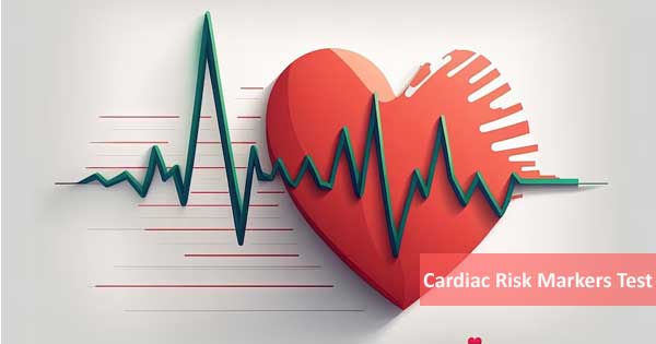 Cardiac Risk Markers Test