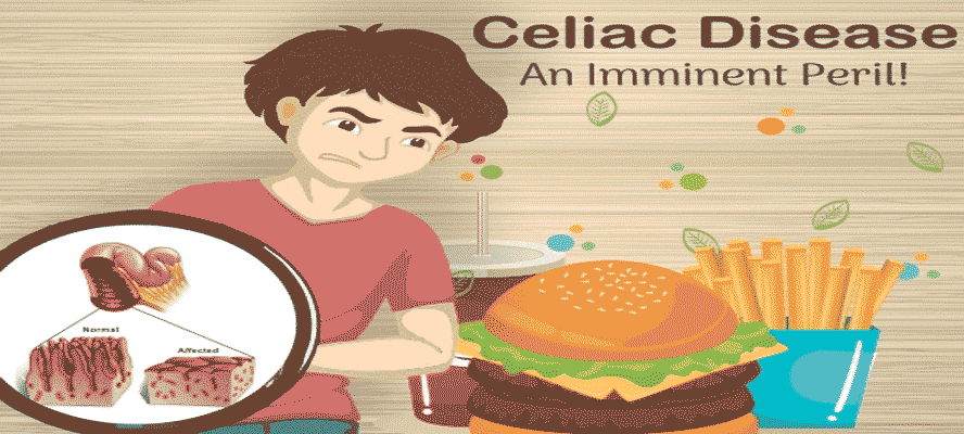 Celiac Disease an Imminent Peril