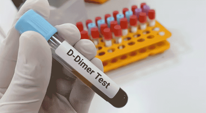 What is D-dimer test ?