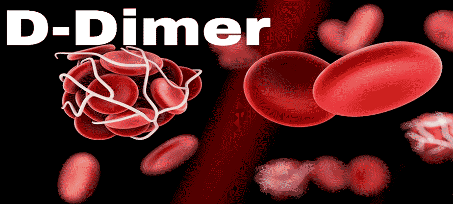 What does high D-dimer levels indicate ?
