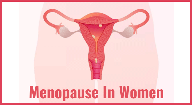 Women Menopause: Age, Stages, Signs, Causes & Complications