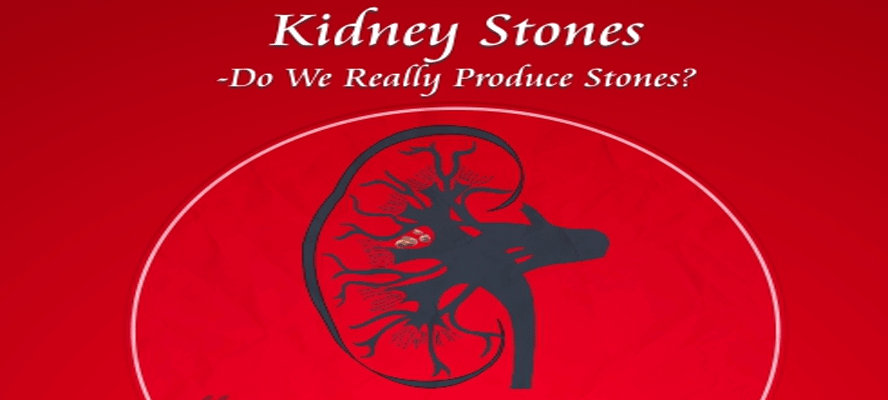 Kidney Stones - Do We Really Produce Stones?