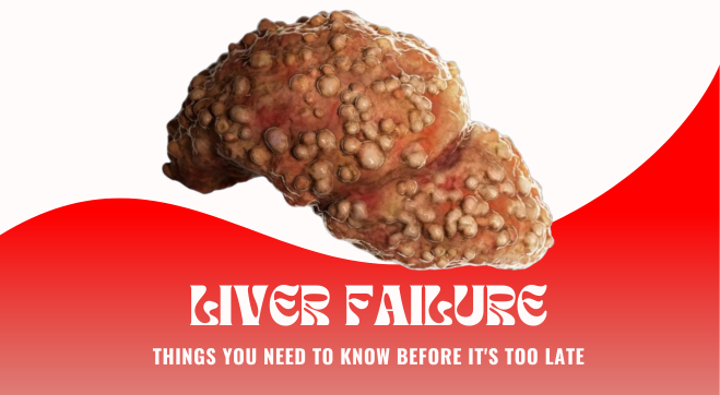 Liver Failure: What Is It, Types, Symptoms, Causes, and Diagnosis