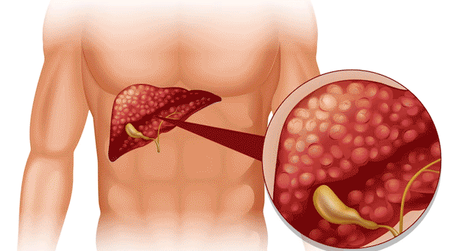 Guide To A Healthier Liver