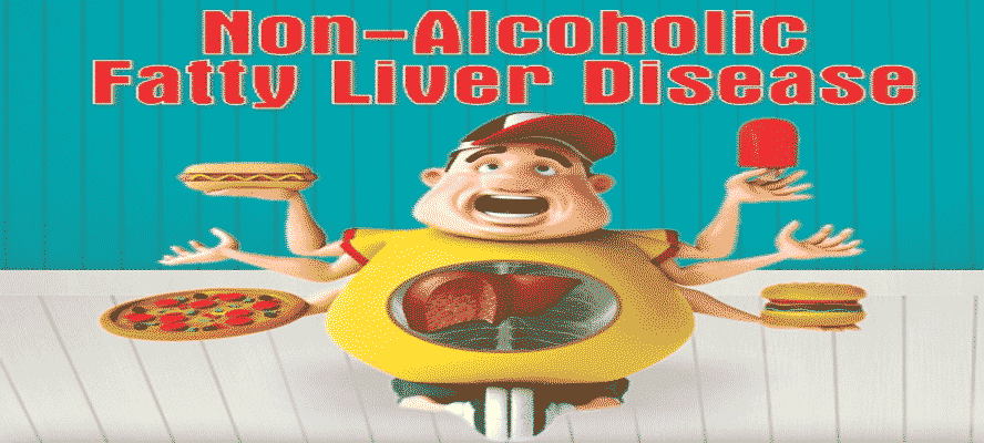 Alcoholic And Non-alcoholic Fatty Liver Disease