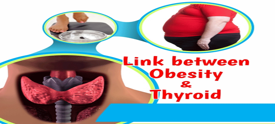 Link Between Obesity and Thyroid - The Insider Look