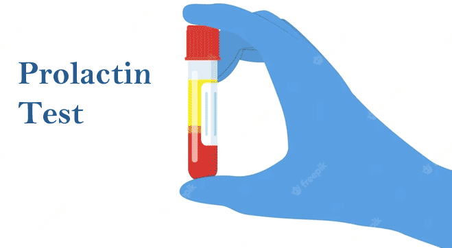 Prolactin Test