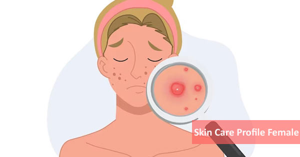 Skin Care Profile Female