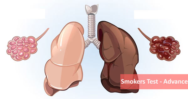 Smokers Test - Advance