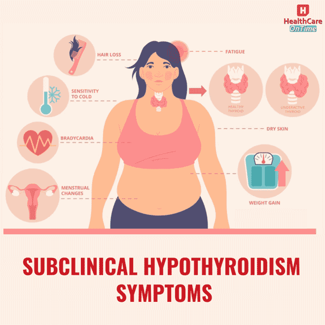 subclinical hypothyroidism symptoms