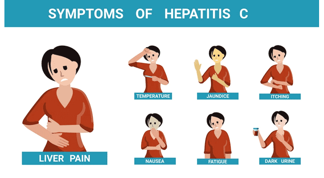 symptoms of hepatitis c