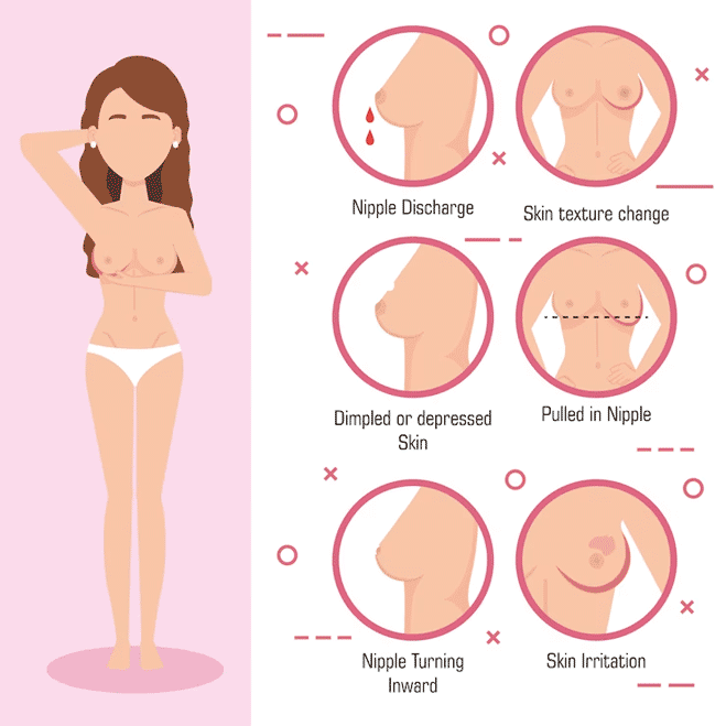 Symptoms of Inverted Nipples