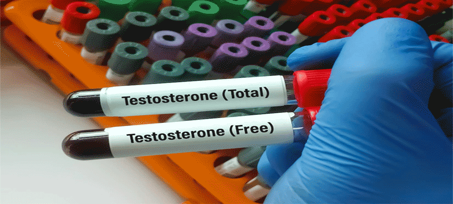 Testosterone Test: Check Testosterone Levels, Procedure & Result