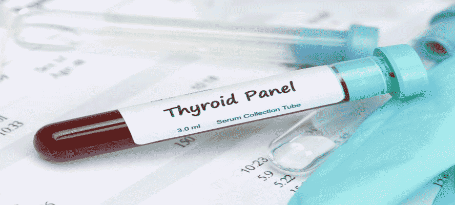 Thyroid Test Investigation and Interpretation