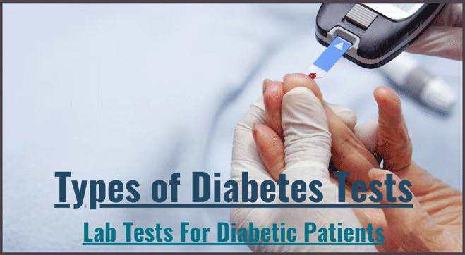 Types of Diabetes Tests: List of Lab Tests For Diabetes Patients