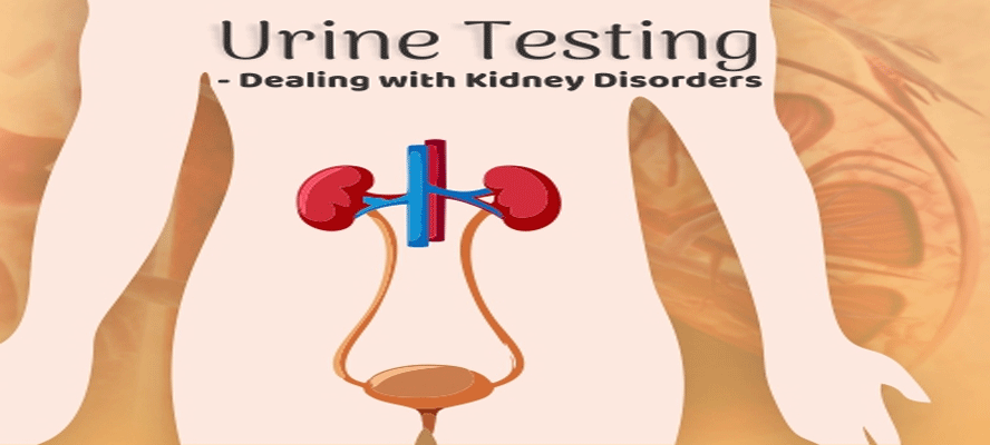 Urine Testing - Dealing With Kidney Disorders