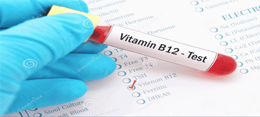 Vitamin B12 Test: Purpose, Procedure & Test Cost