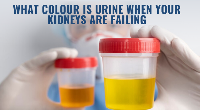 What Colour Is The Urine When Your Kidneys Are Failing?