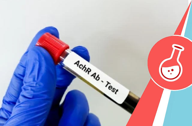 AChR Antibody Test