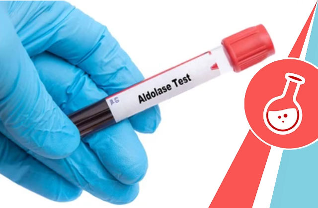 Aldolase Blood Test