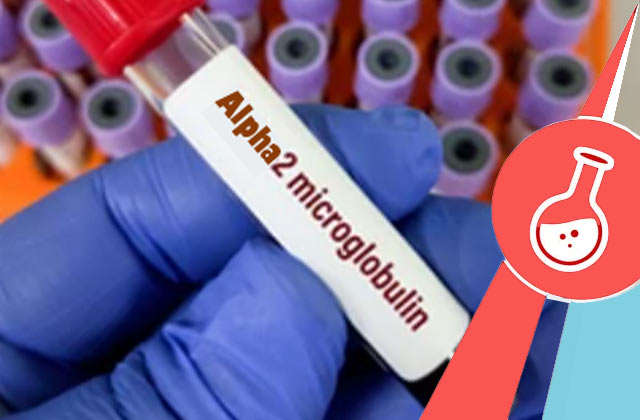 ALPHA 2 Macroglobulin Test