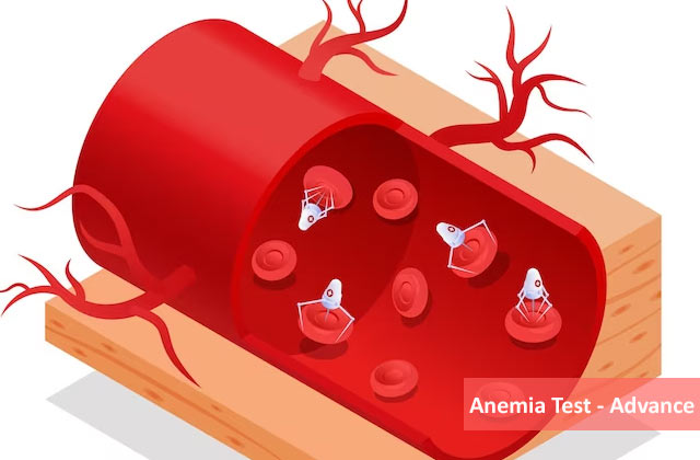 Anemia Blood Test  - Advance