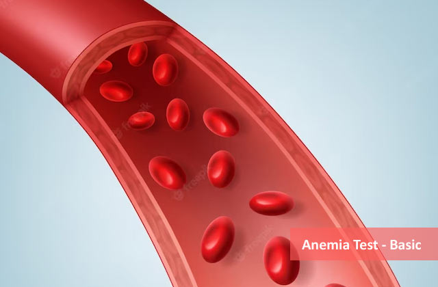 Anemia Blood Test - Basic