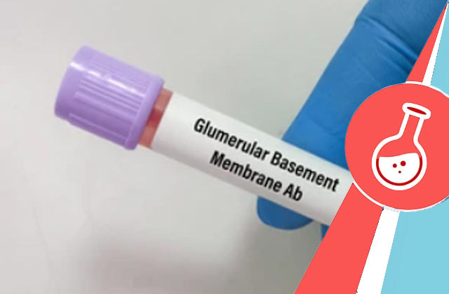 Glomerular Basement membrane Antibody