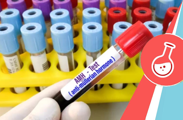 AMH Test (Anti Mullerian Hormone Test)