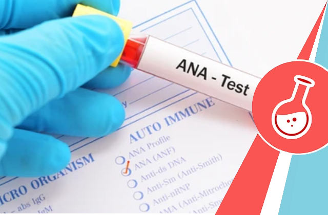 ANA Test (Antinuclear Antibody Test)