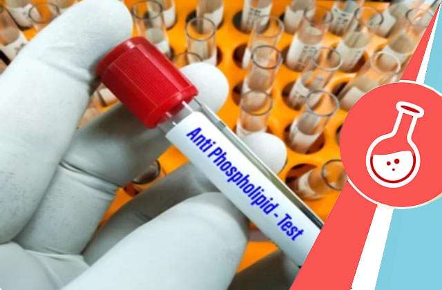 APLA Blood Test (Anti Phospholipid Antibody IgG)