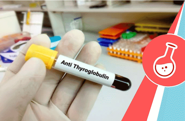 Anti Thyroglobulin Antibody (Anti Tg Test)