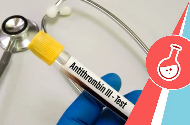 Antithrombin iii Test