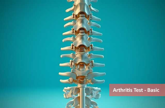 Arthritis Test - Basic