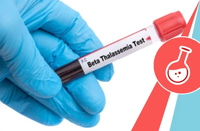 Beta Thalassemia Screening Test