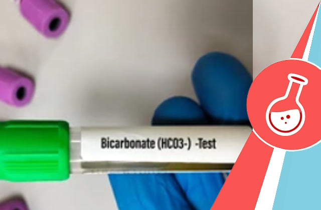 Bicarbonate Test (HCO3- Blood Test)