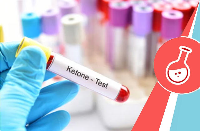 Blood Ketone Test (D3HB Test)