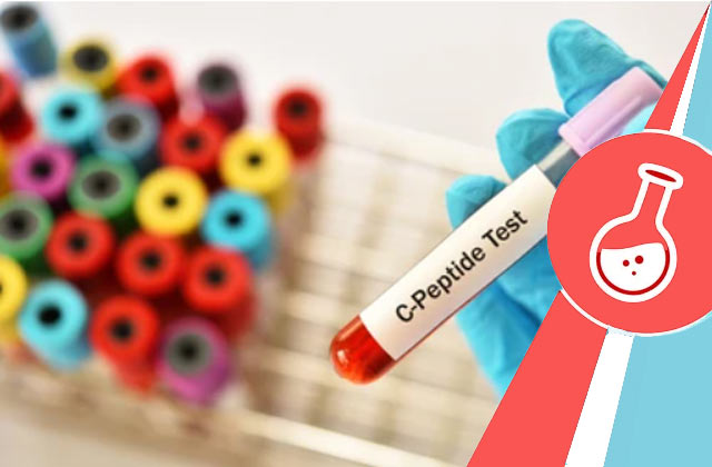 C-peptide Test