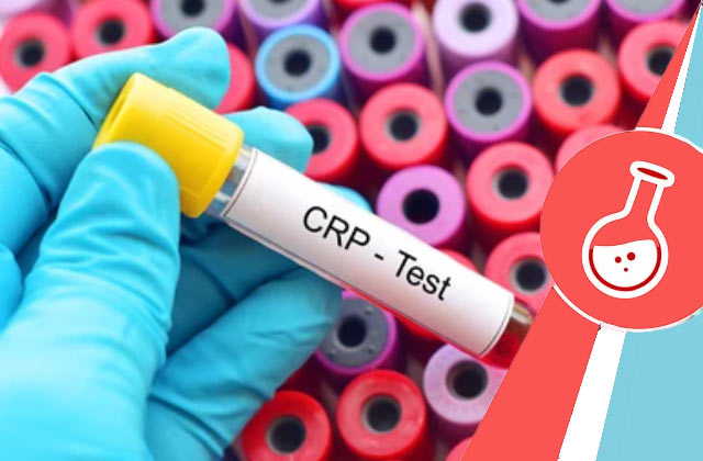 CRP Test (C-Reactive Protein)
