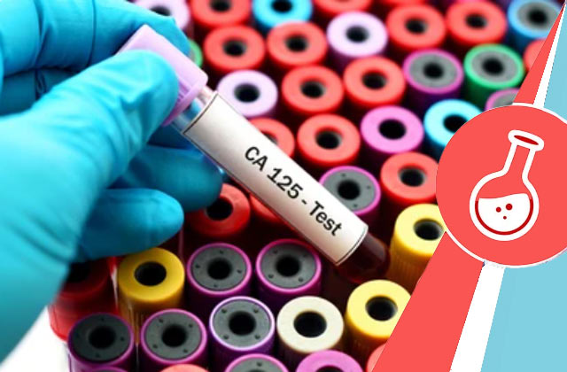 CA-125 Test (Cancer Antigen Test)