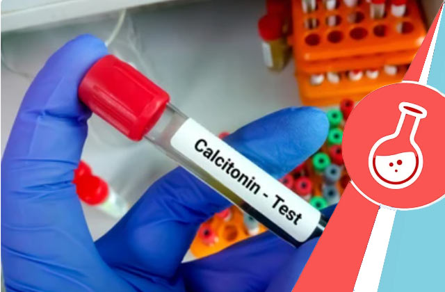 Calcitonin Test