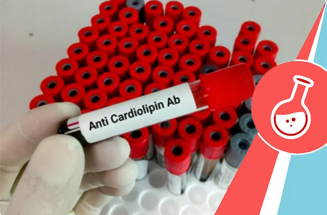 Cardiolipin Antibody aCL - IgA Test