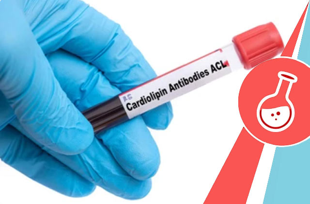 Cardiolipin Antibody aCL - IgG Test