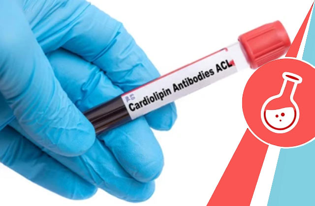 Anti-Cardiolipin Antibody (ACL) - IgM