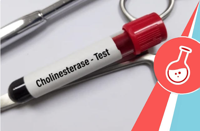 Cholinesterase Test (Pseudocholinesterase Test) 