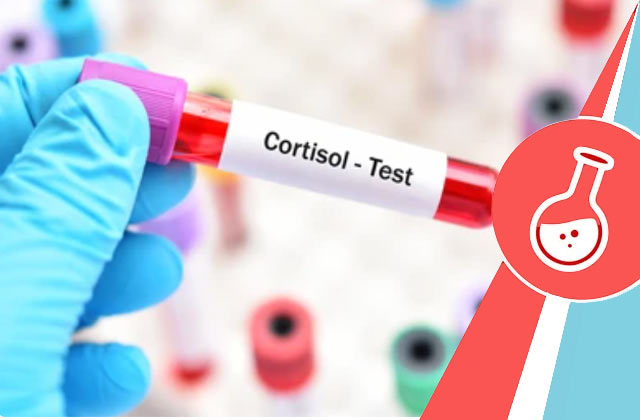 Cortisol Test, Check Cortisol Levels @ Rs 500