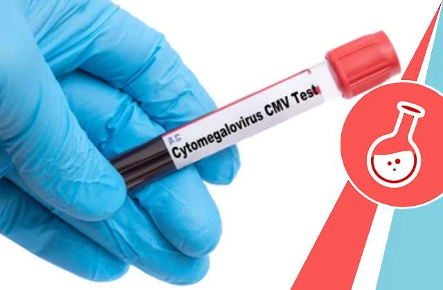 Cytomegalovirus IgG Antibody (CMV  IgG)